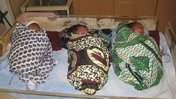What I’m learning as a nurse in Malawi